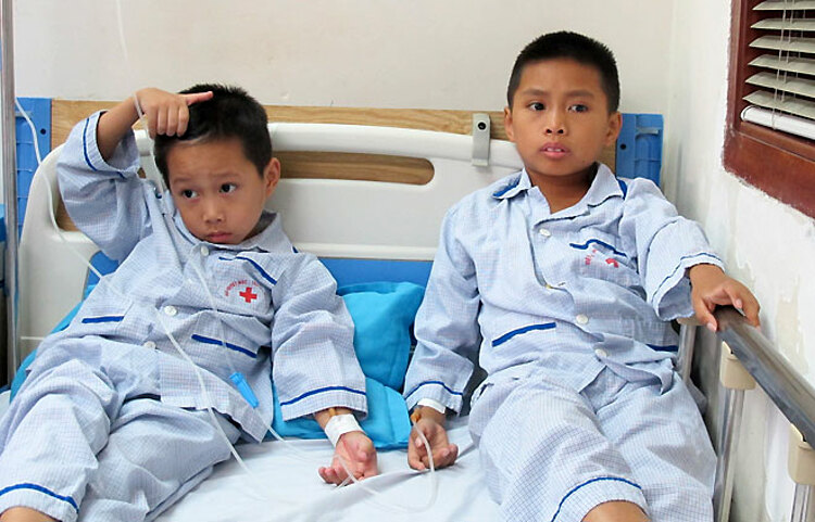 Bệnh nhân tan máu bẩm sinh được truyền máu tại Bệnh viện. Ảnh: Nam Phương